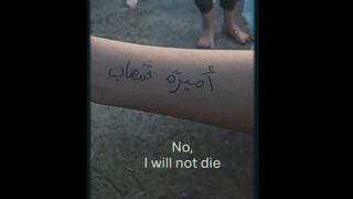 Gazzeli ailelerin çocukların kollarına isim yazması Almanya'da protestoya dönüştü