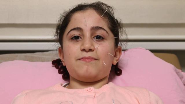 Y�z felci ge�iren �ocuk akupunktur ile sa�l���na kavu�tu