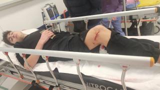 Başıboş köpekler okula giden öğrenciye saldırdı