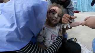 İsrail saldırısında yaralanan 3 yaşındaki kız çocuğu korkudan titredi