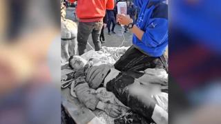 Gazzeli yaralı çocuk, eşek arabasında böyle taşındı