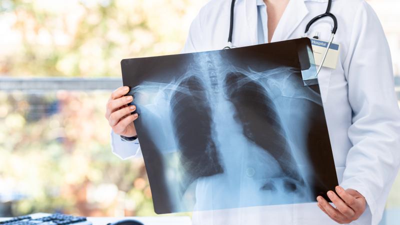 T�berk�lozdan korunmak m�mk�n