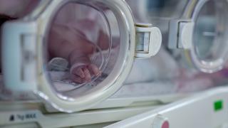 Bebeklerde kafatasında şekil bozukluğuna dikkat