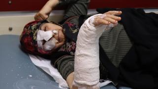 Başıboş köpeklerin saldırdığı kadın merdivenlerden düştü