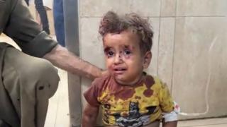 İsrail sivillere ölüm yağdırmaya devam ediyor