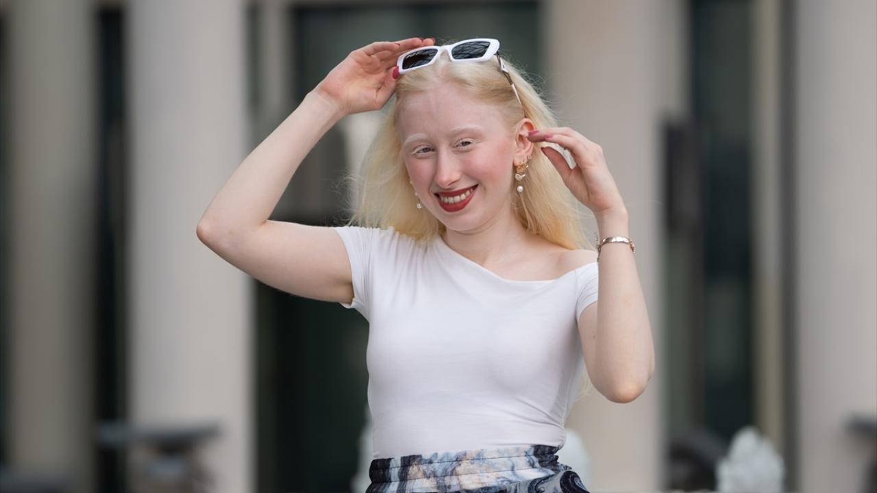 Olumsuz yorumlara takipçileri cevap veriyor