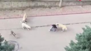Başıboş köpeklerin saldırdığı çocuk yaralandı