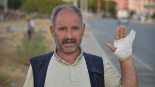 Başıboş köpeğin saldırdığı kişi parmağını kaybetme riski yaşıyor