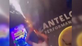 Klarnetiyle şov yapmak isterken kendini yaktı