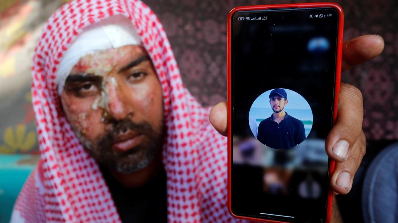 "Gözümün önünde yandılar"