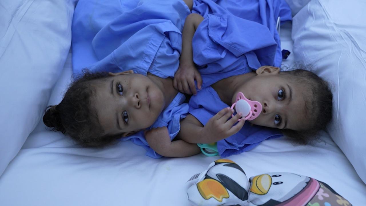 "Dünya üzerinde görülme sıklığı çok düşük"