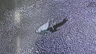 Başıboş köpeğin saldırdığı çocuk yaralandı