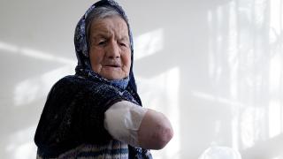 Ankara'da başıboş sokak köpeğinin saldırdığı yaşlı kadın yaralandı