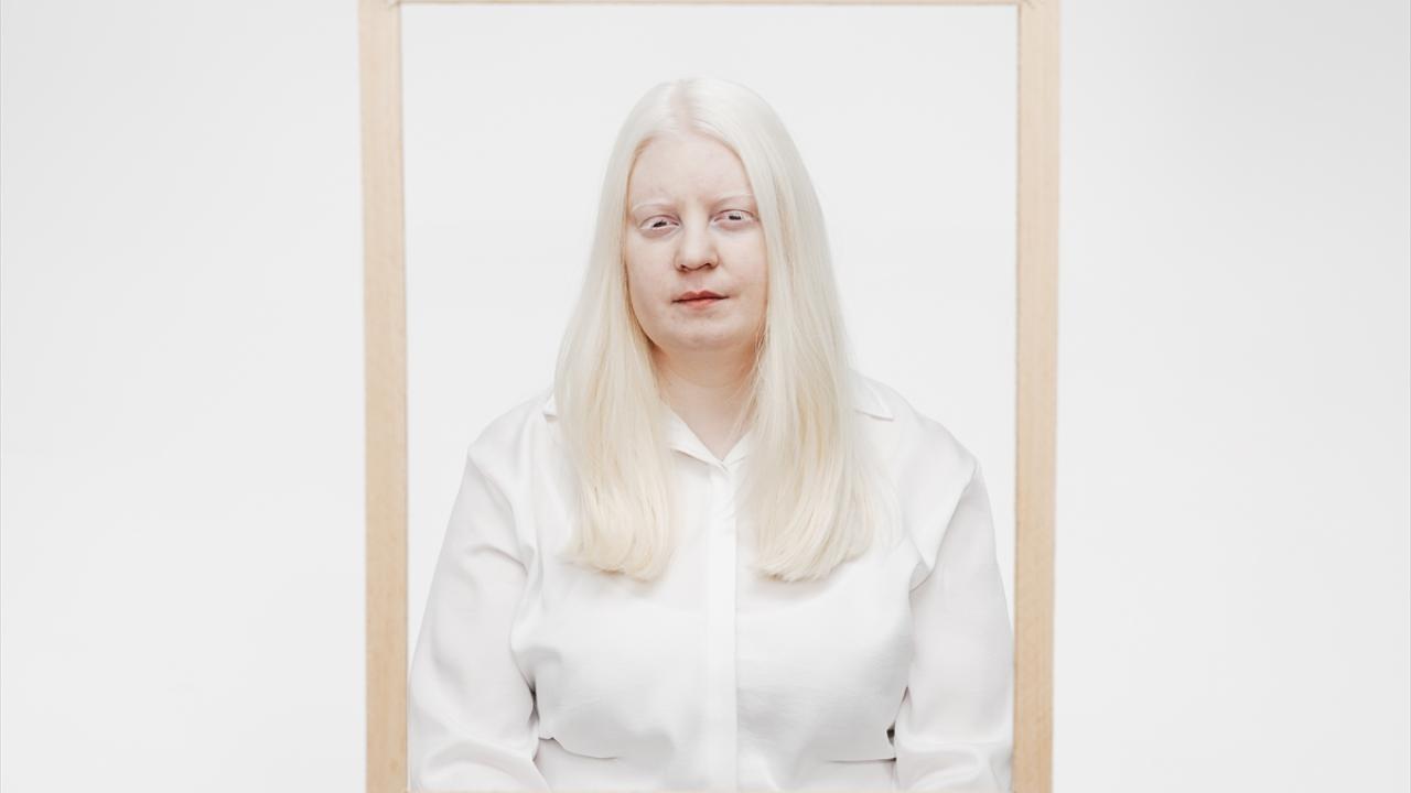 ⁠"Nadir bir hastalık olduğu bilinmiyor"