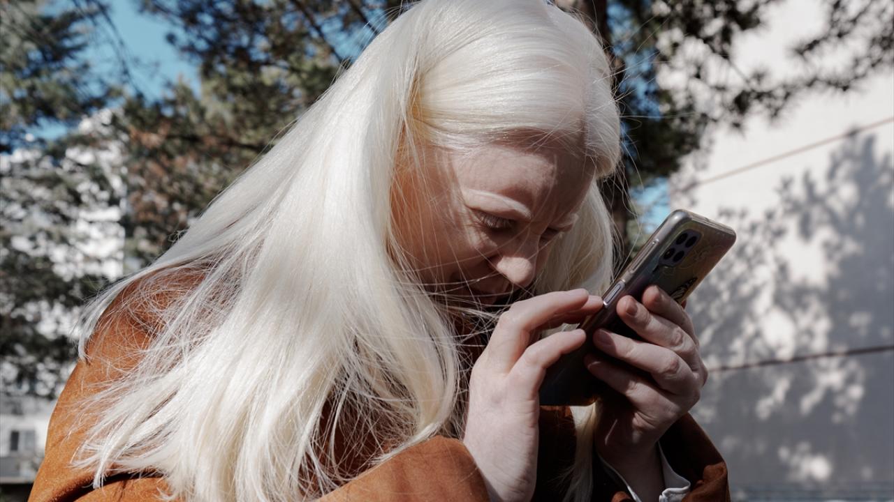 ⁠"Beni en çok zorlayan, az görüyor olmak"