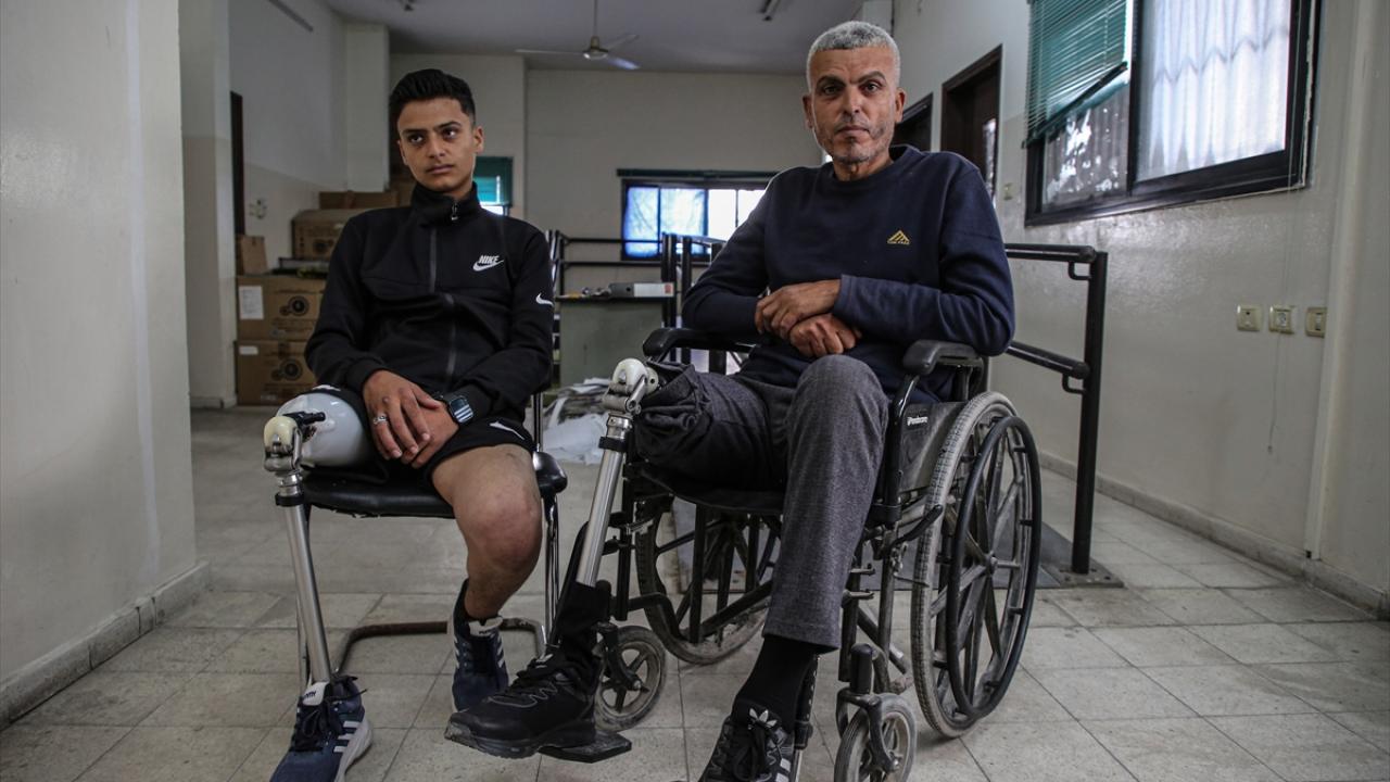 "Bacağımı göz göre göre kaybettim"