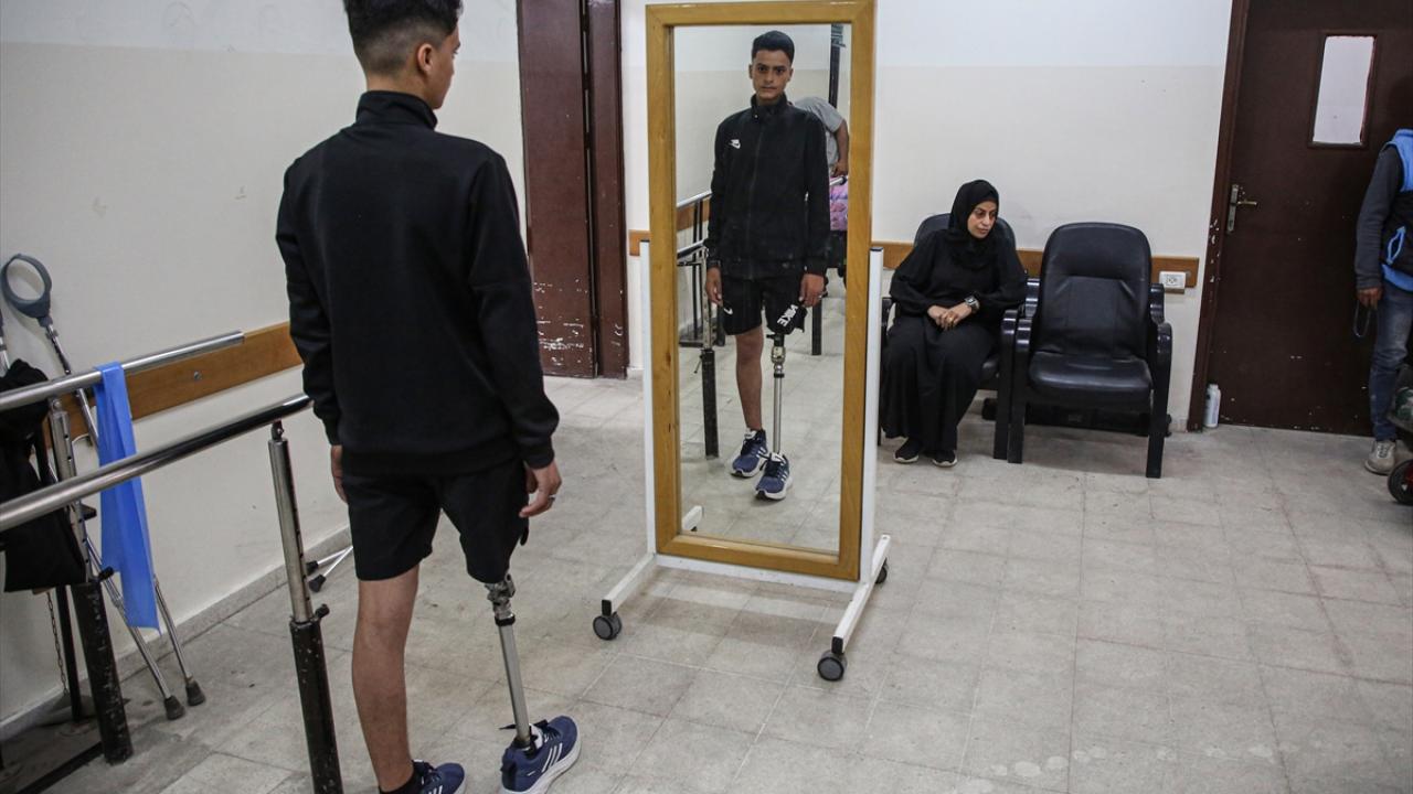 "Gazze Şeridi`ndeki tüm kentlerde yaklaşık 4 bin 700 uzuv kaybı kaydedildi"