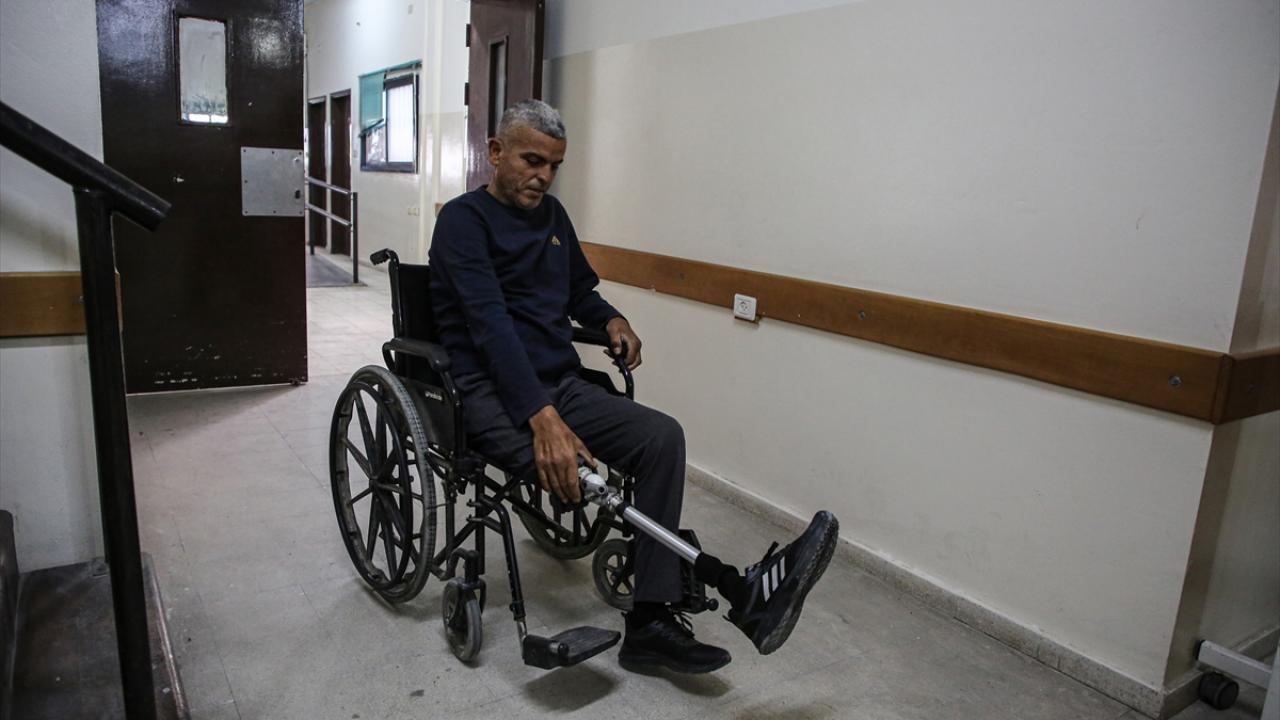 Hayatlarını onurlu şekilde sürdürebilmelerini sağlayacak gelişmiş protez hayali kuruyorlar