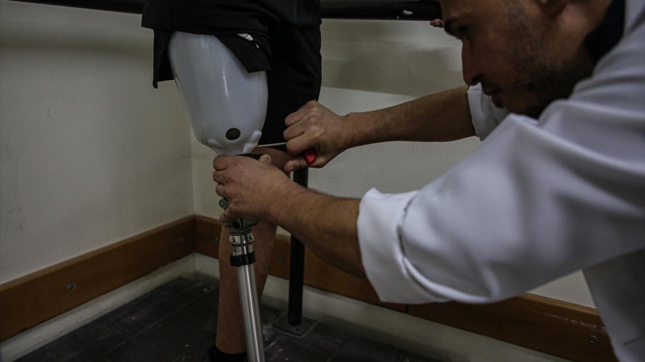 Yeni ampütasyon vakalarının yüzde 48`i kadın, yüzde 20`si çocuk