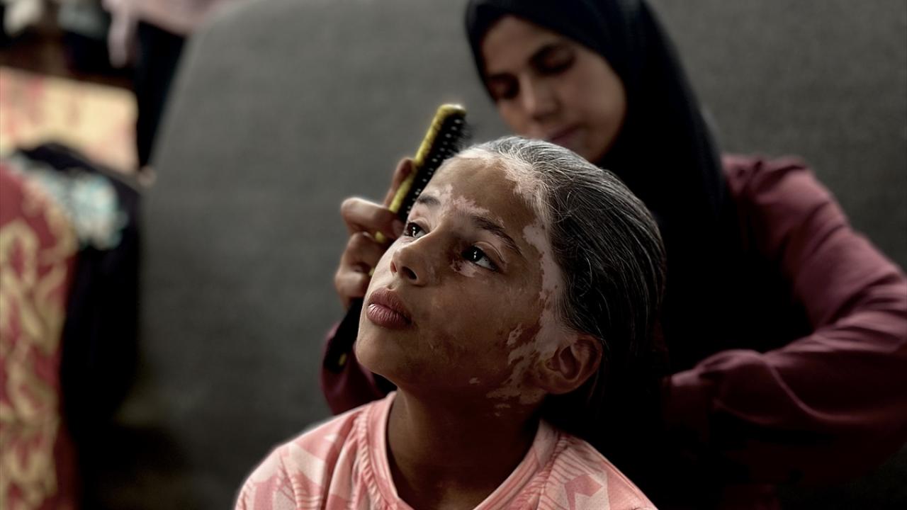 Gazze`de tedavi imkanı yok