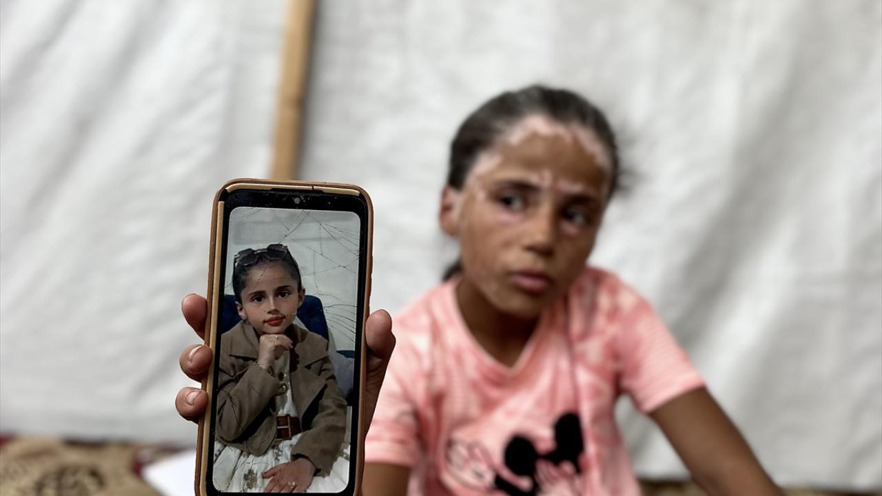 Arkadaşları beyazlayan saçlarından ötürü onu yaşlı sanıyor