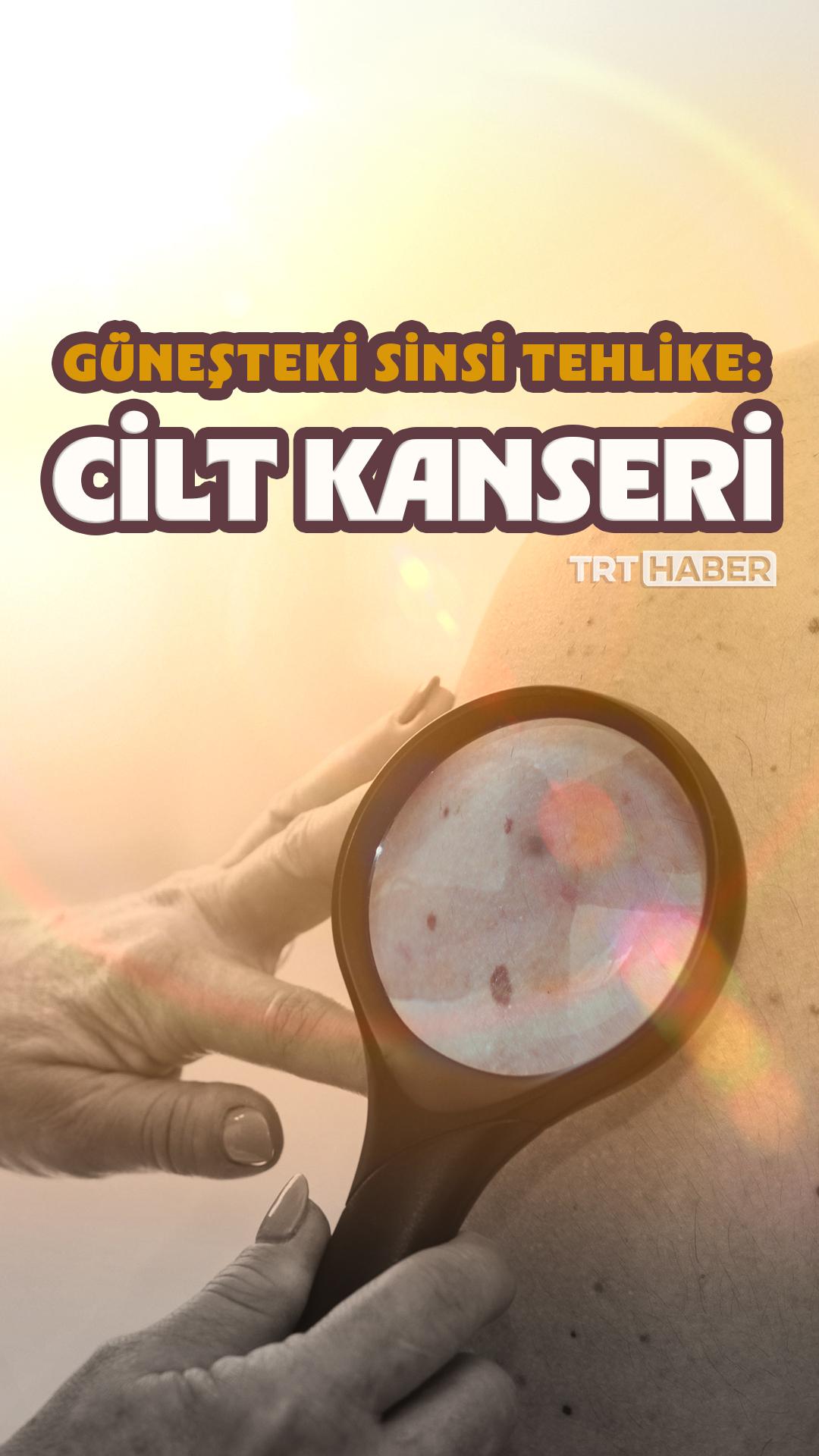 Güneşteki sinsi tehlike: Cilt kanseri