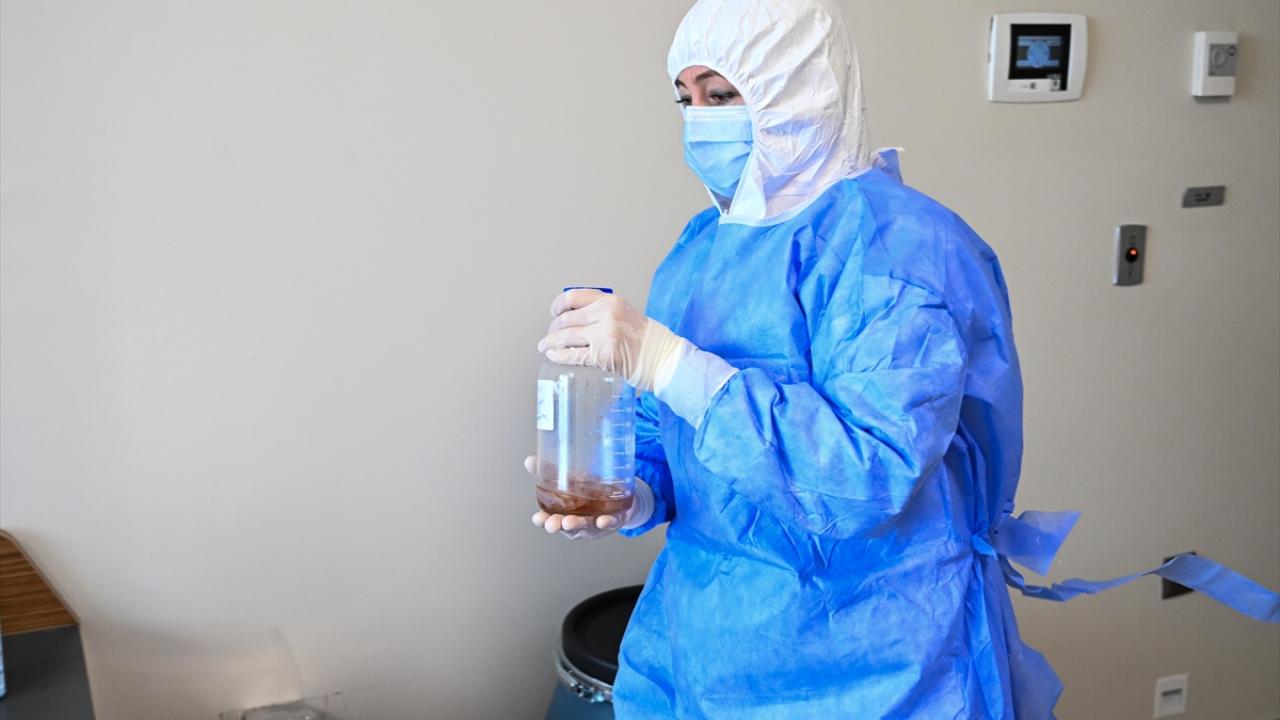 "Alınan deri 2 ila 5 yıl boyunca saklanabiliyor"