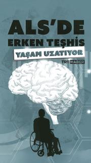 ALS’de erken teşhis yaşam uzatıyor