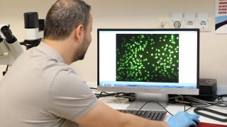 Bilim insanları, Alzheimer hastalığını kan tahliliyle erken teşhis için çalışıyor