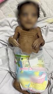 Soykırımcı İsrail'in ablukası Gazze'de bir bebeği daha öldürdü