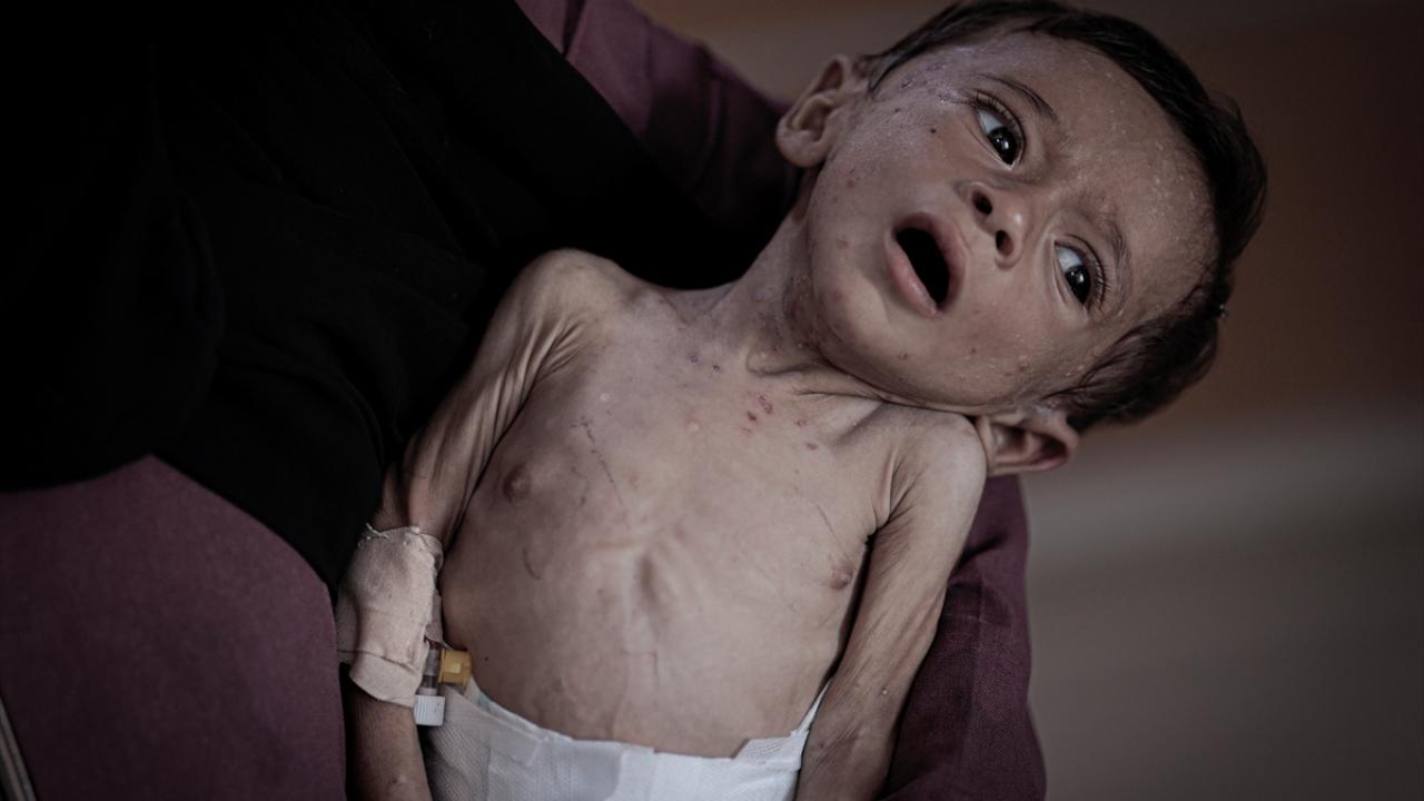 7 aylık Hasan Ahmed Felfel