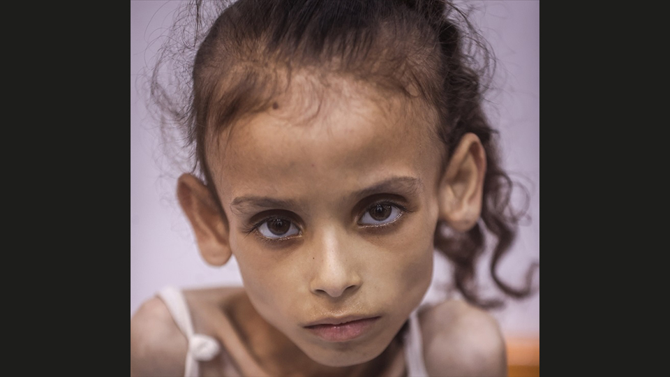 9 yaşındaki Meryem Duvvas