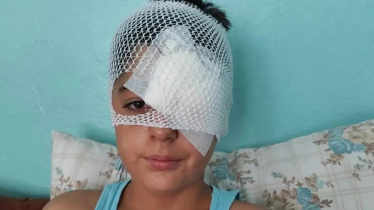 Şanlıurfa'da başıboş köpek saldırısından kaçan çocuğa otomobil çarptı
