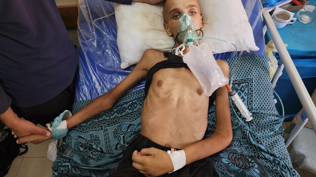 1 ayda 20 kilo kaybetti