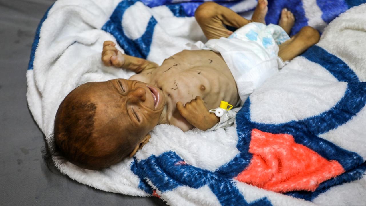 Gazze’deki hasta çocuklar, umutsuzca yurt dışında tedavi olacakları günü bekliyor