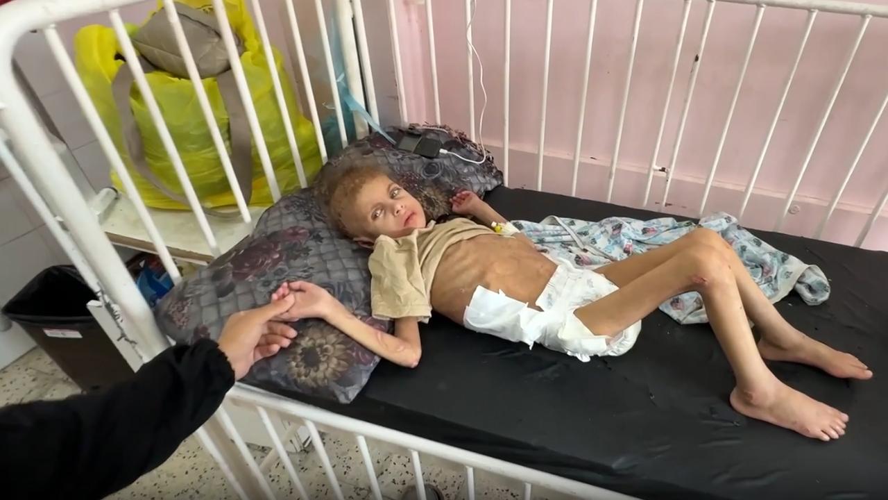 Gazze’de yetersiz beslenme sonucu 12 kiloya düşen 7 yaşındaki May yürüme yetisini kaybetti