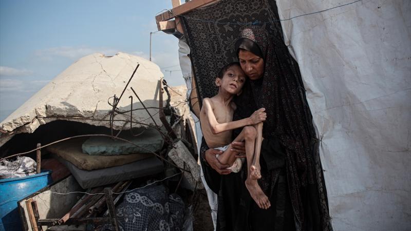 Qəzzada aclıqdan ölənlərin sayı artdı