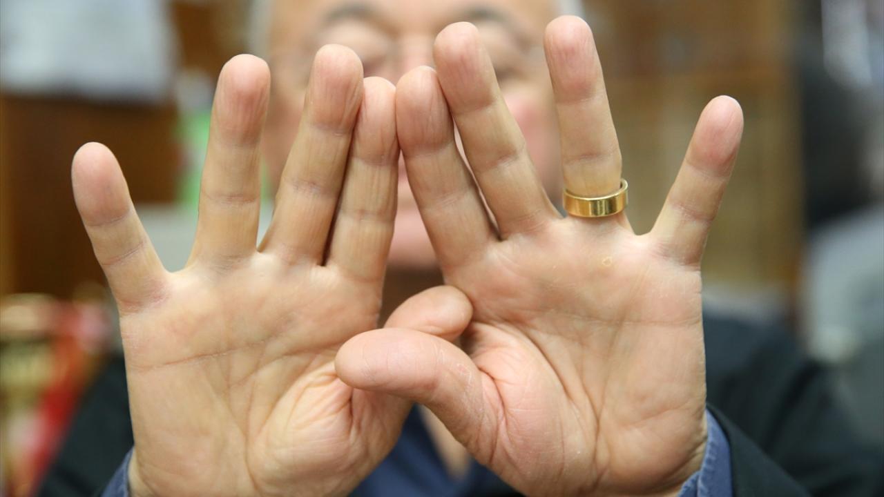 "İki parmak izimi net alabildi, diğerleri çıkmadı"