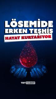 Lösemide erken teşhis hayat kurtarıyor