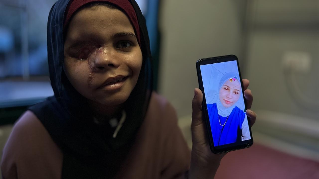 İsrail saldırısına maruz kalan Gazzeli çocuk görme yetisini kaybetme riski yaşıyor