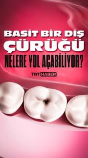 Basit bir diş çürüğü nelere yol açabiliyor?