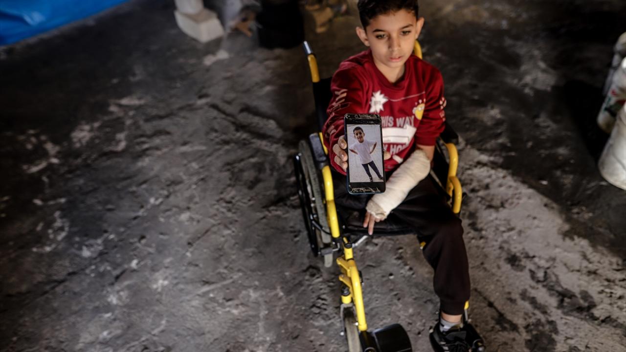 İsrail saldırılarında bir bacağını kaybeden çocuk, tekerlekli sandalyeye mahkum oldu