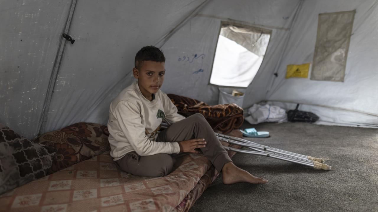 İsrail saldırısında bir bacağını kaybeden Filistinli çocuk ailesinin yardımıyla yaşama tutunuyor