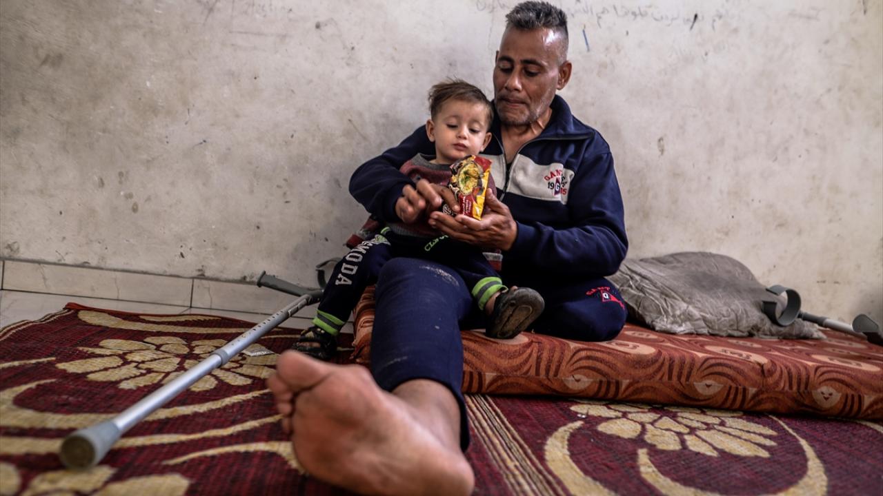 İsrail saldırısında oğlunu ve bir bacağını kaybeden Gazzeli baba, ailesi için yaşama tutunuyor