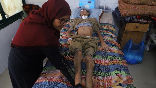 İsrail saldırısında ağır yaralanan Filistinli Hamed, hayatta kalma mücadelesi veriyor