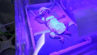 Gazze'de prematüre bebekler hayatta kalma mücadelesi veriyor