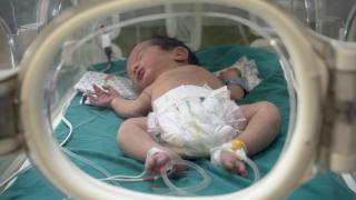 Gazze'de prematüre bebekler hayatta kalma mücadelesi veriyor