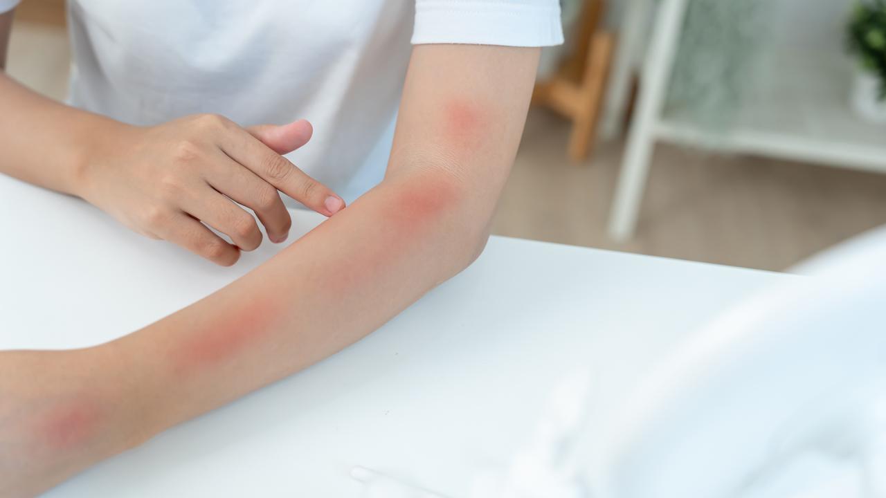 Arkadaşına doğum günü sürprizi yapmak isterken kolu yandı