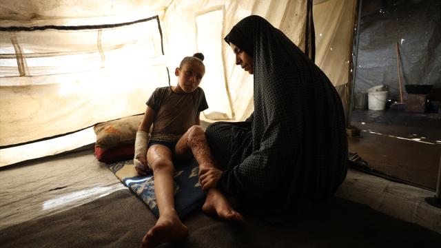 İsrail saldırılarında ağır yaralanan Filistinli çocuk yürümekte zorluk yaşıyor