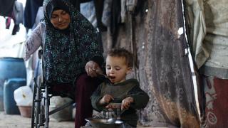 İsrail saldırısında uzuvlarını kaybeden Filistin kadın yaşama tutunmaya çalışıyor